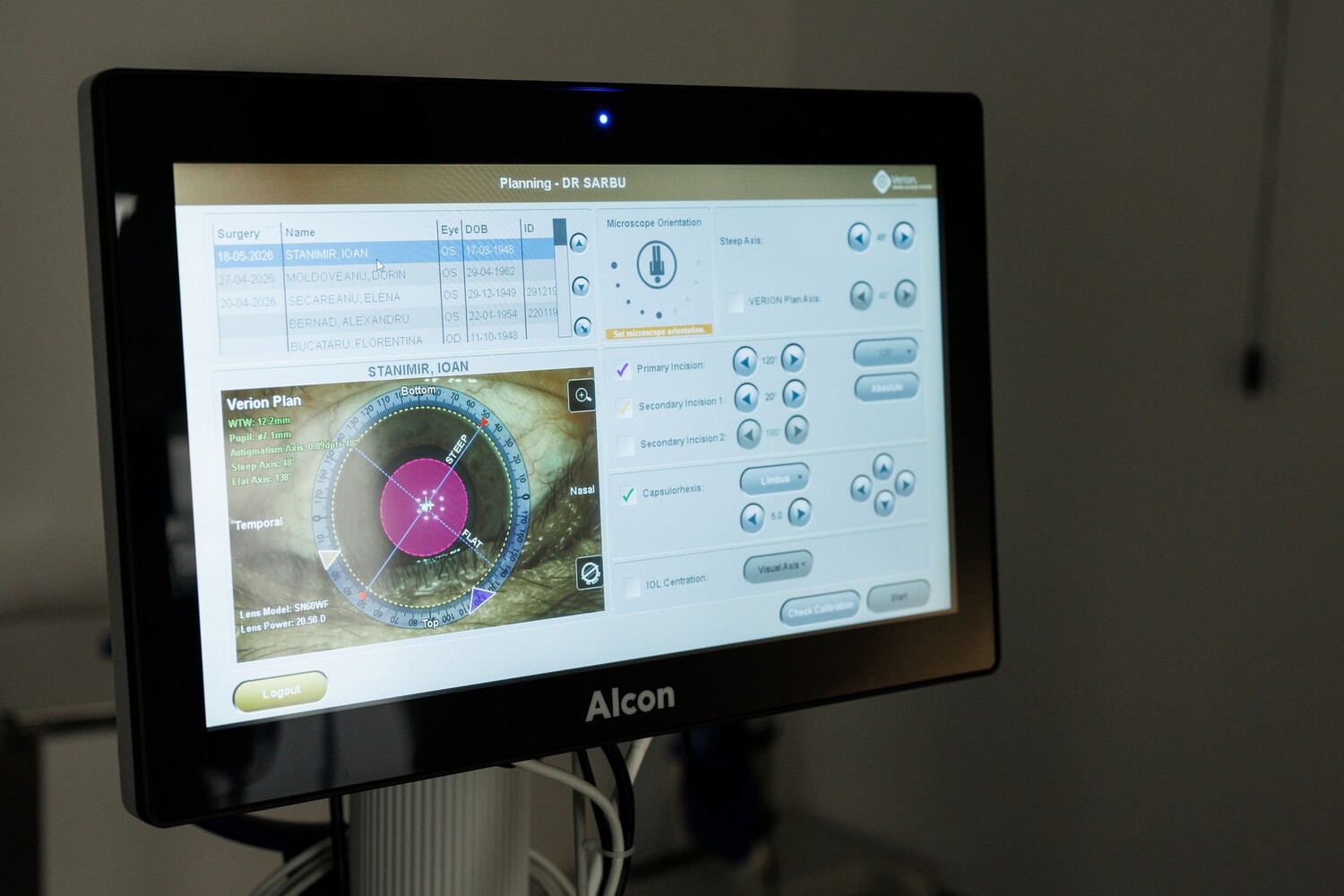 Planificarea digitală a operației de cataractă pe sistemul Alcon Verion